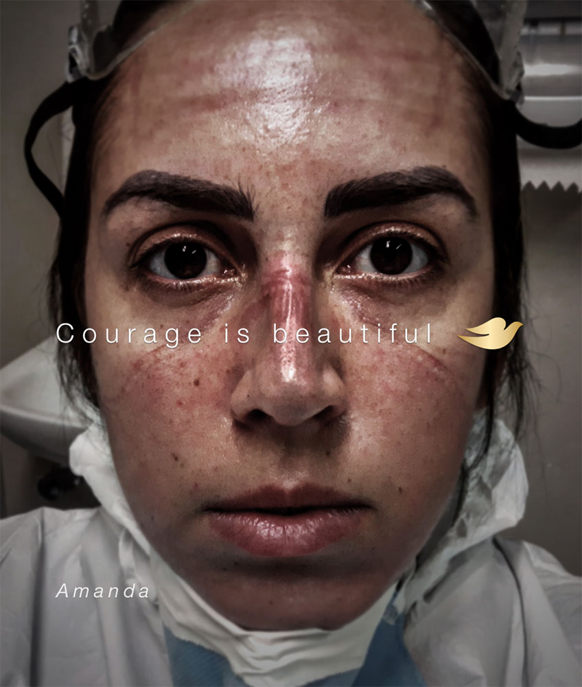 A person wearing a surgical mask, with a red patch on their face, sitting in front of a medical setting.